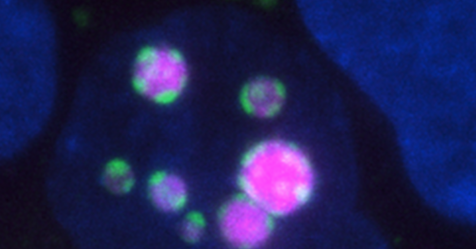 Confocal image of green and magenta synthetic RNA condensates inside living cells