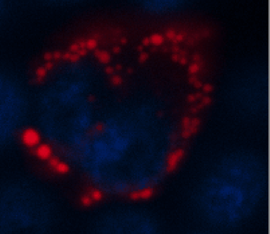Time-lapse of red condensates forming inside cells