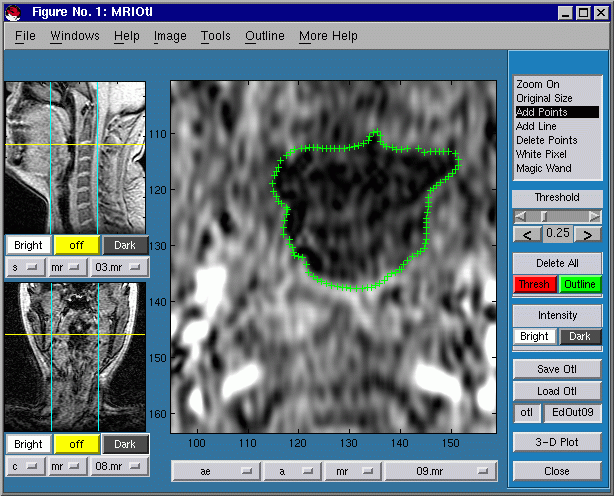 CTMRedit window, with outline loaded from the
distribution