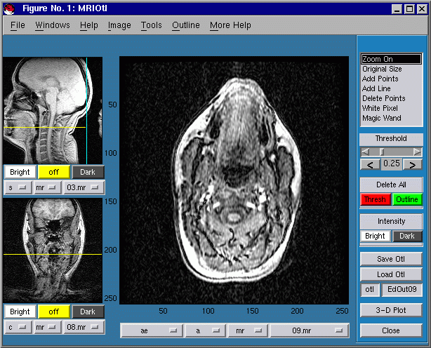 CTMRedit window, with full-sized main image