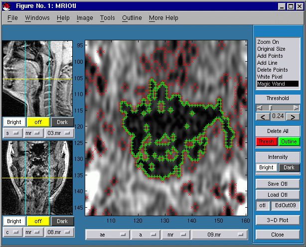 CTMRedit
window, region outlined using Magic Wand