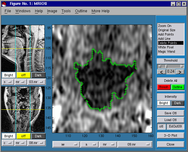 CTMRedit window, outline cleaned up using Delete Points