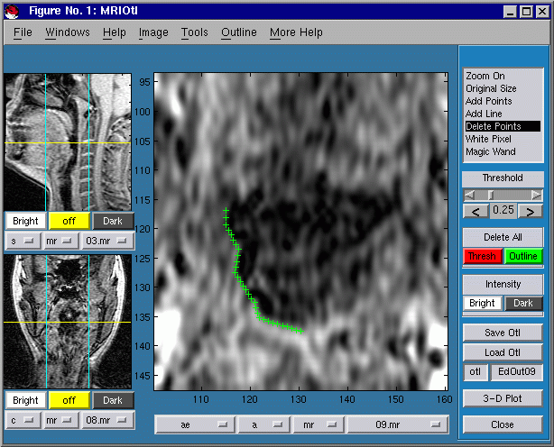 CTMRedit window, multiline converted to outline points