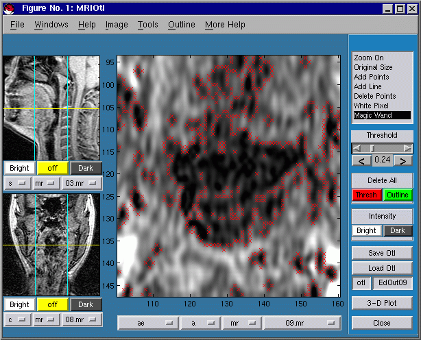 CTMRedit window, showing threshold-crossing points