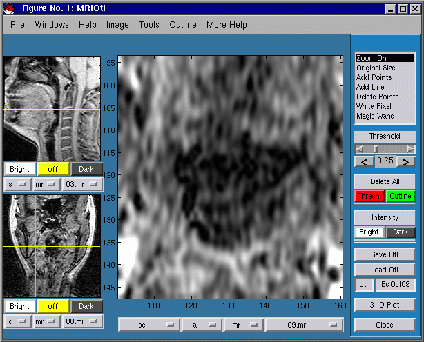 CTMRedit window, with zoomed main image