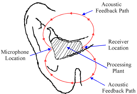 [AEPTF of an ITE Hearing Aid]